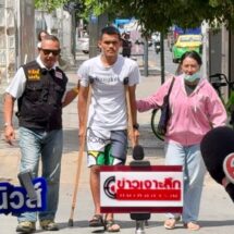 หนุ่มไรเดอร์ร้องกองปราบฯ ถูกฟอร์จูนเนอร์ชนขาหัก ไร้เยียวยา ซ้ำคดีไม่คืบ ต้องใช้ไม้เท้าค้ำยันวิ่งส่งอาหาร