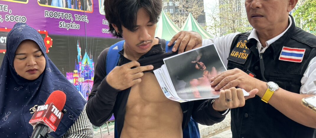 นายแบบอิสระหนุ่มอนาคตดับ ร้องกองปราบฯ คดีอืด 8เดือน ถูกแท็กซี่ตัดหน้ากรามหัก-กินข้าวผ่านสลิง ไร้เยียวยา