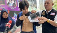 นายแบบอิสระหนุ่มอนาคตดับ ร้องกองปราบฯ คดีอืด 8เดือน ถูกแท็กซี่ตัดหน้ากรามหัก-กินข้าวผ่านสลิง ไร้เยียวยา