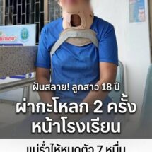 สลด! 2 แม่ลูกถูก “กำนัน” ซิ่งชนท้ายหน้าโรงเรียน ลูกสาว 18 ฝันอยากเป็นพยาบาล ต้องผ่ากะโหลก 2 ครั้ง แม่ร่ำไห้หมดตัวค่ารักษา 7 หมื่น แต่คู่กรณีบอกช่วยได้แค่ 26,000มุกดาหาร – ครอบครัวสุดช้ำ ร้องขอความเป็นธรรม หลัง 2 แม่ลูกถูก